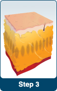 Corps non envahissant contournant la cavitation ultrasonique rf de liposuccion amincissant la machine Liposonix