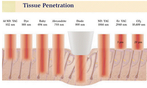 Durée portative d'impulsion de la CE de machine d'épilation de laser de la diode 808nm