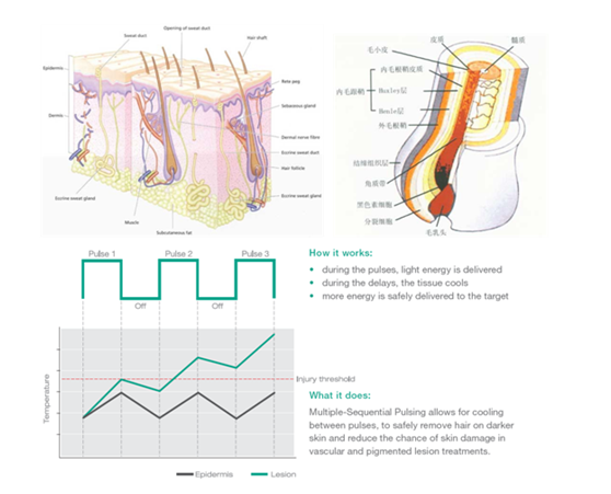 1 - poignées médicales de la machine 3 d'épilation du chargement initial SHR de technologie de l'impulsion 10Hz