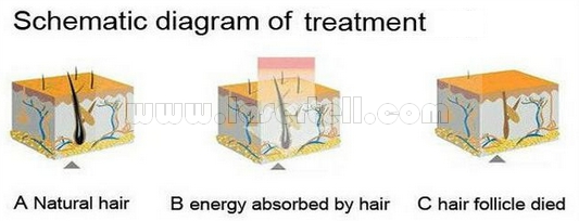La douleur permanente de machine d'épilation de laser de la diode 808nm libèrent pour la clinique/salon de beauté
