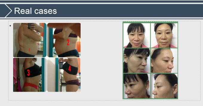 Système de Cavitation+Vacuum+RF+Laser+Roller amincissant le CE d'équipement de beauté