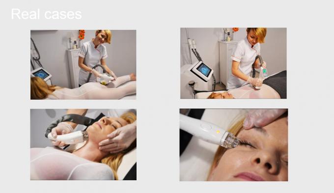 Système de Cavitation+Vacuum+RF+Laser+Roller amincissant le CE d'équipement de beauté