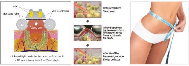 vide rf de la cavitation 40K amincissant la machine V9 Velashape avec la certification de la CE