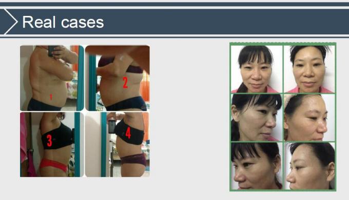 vide rf de la cavitation 40K amincissant la machine V9 Velashape avec la certification de la CE