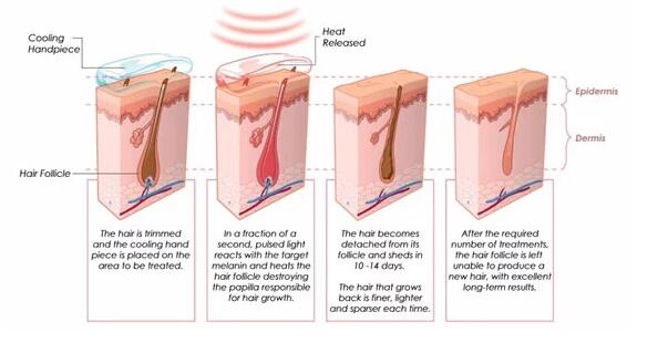 Refroidissement TECHNIQUE actif de chargement initial de machine permanente de laser avec des barres de laser de l'Allemagne