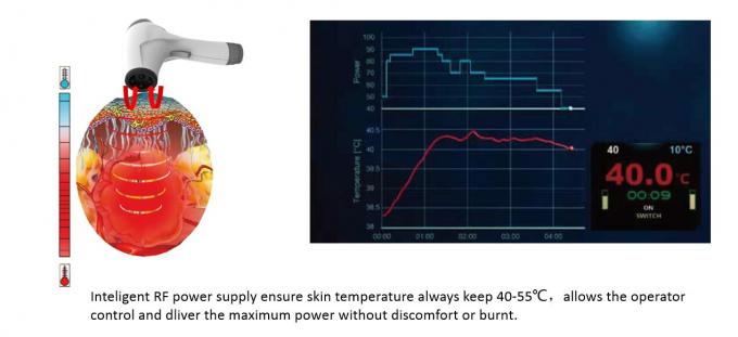 Serrage maximum de peau de laser de la machine rf Thermolift de levage de visage de la beauté 80W