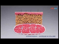 Machine de stimulation musculaire électromagnétique HI-EMT